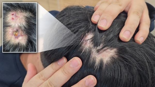 ▲ 자료사진 정기훈 기자